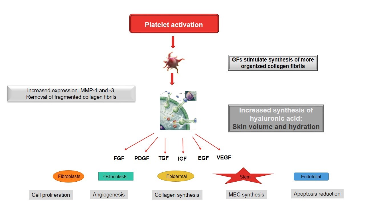 Mechanisms of action of autologous platelet concentrates in facial rejuvenation. After platelets activation, their α granules fuse with the cell membrane, in a process called degranulation. Their growth factors are then secreted, bind to transmembrane receptors on target cells (mesenchymal stem cells, osteoblasts, fibroblasts, endothelial and epidermal cells), activating an intracellular signaling protein that causes the expression of a protein, which, in turn, triggers effects such as cell proliferation, angiogenesis, synthesis of collagen and extracellular matrix components, and reduced apoptosis. With skin aging, fragmented collagen fibrils accumulate, which impairs the growth of new collagen fibers and disrupts the extracellular matrix. Activated platelet aggregates increase the expression of matrix metalloproteases (MMP-1 and -3), stimulating the removal of fragments of collagen fibrils. In addition, they contain several growth factors that stimulate fibroblasts to synthesize new, more organized collagen fibers, besides increasing the synthesis of hyaluronic acid, which binds to water, increasing the skin volume and hydration